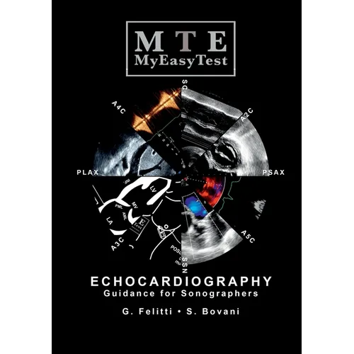 Echocardiography - MyEasyTest - Paperback - IBook Store