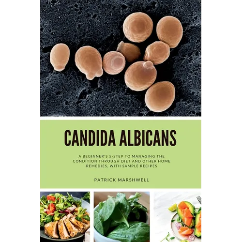 Candida Albicans: A Beginner's 5-Step to Managing the Condition Through Diet and Other Home Remedies, With Sample Recipes
