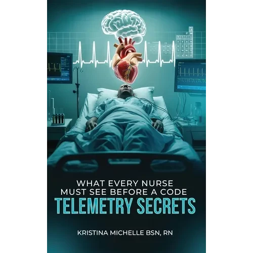 What Every Nurse Must See Before a Code: Telemetry Secrets - Hardcover