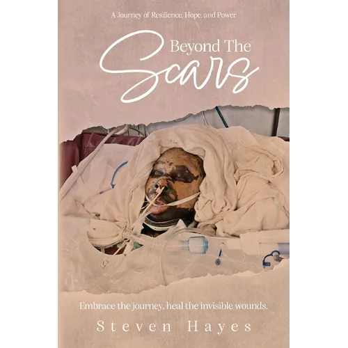 Beyond The Scars: A Journey of Resilience, Hope, and Power