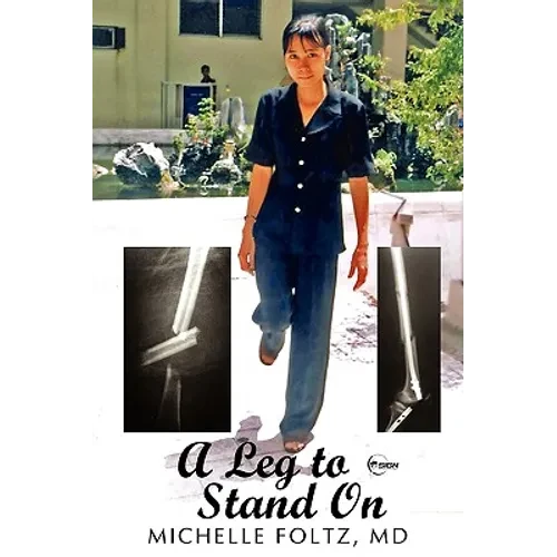 A Leg to Stand On - Paperback